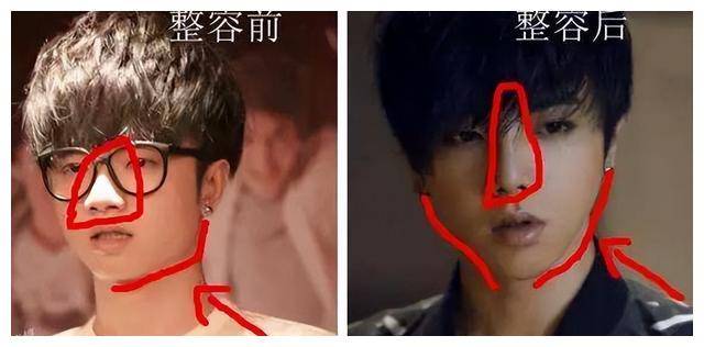 原创明明脸型由大变小，为何拒不承认整容手术？