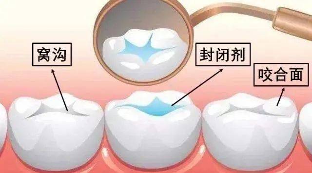 番茄视频：2024澳门天天六开彩免费资料-健康夜话 | 别人家的孩子  第2张