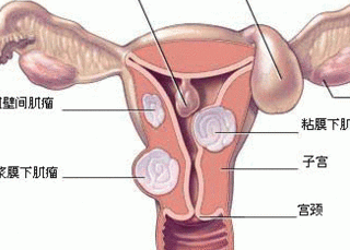 女人月经后多吃它，排出子宫毒素，抑制癌细胞，预防宫颈囊肿