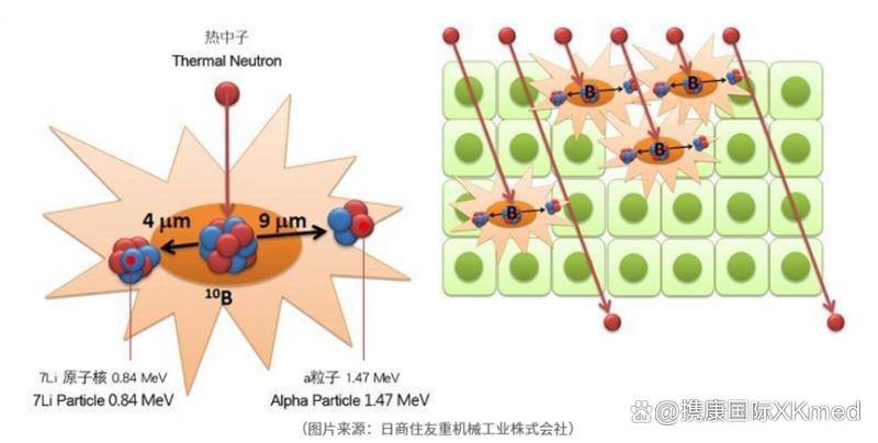 硼中子俘获治疗癌症治疗的主要优势是该方法具有很高的生物学效力和准