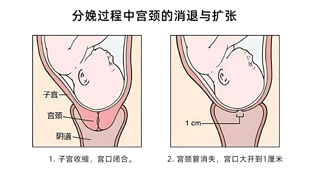 魅可蜜丨子宫内膜炎是怎么引起的？(图1)