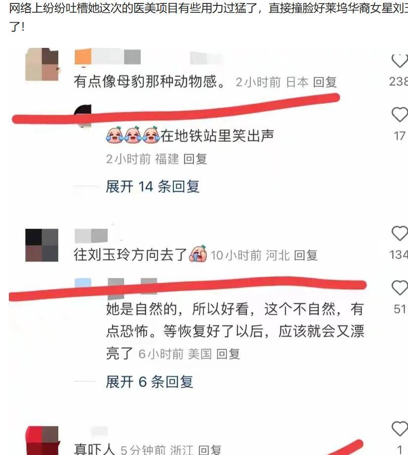 40岁戚薇大变化，医美过度的她，引网友搞笑评价，容貌太焦虑