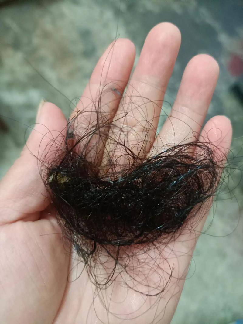 女人突然掉头发很厉害是什么原因？原来这样