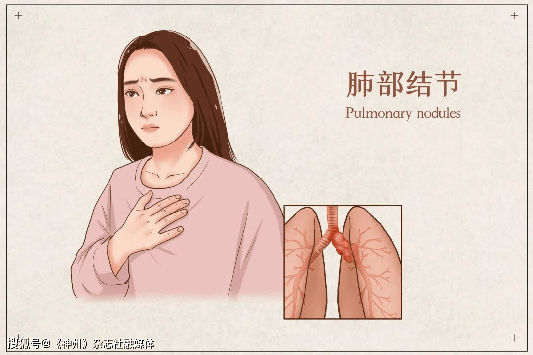 肺结节是怎么形成的？怎么样才能消除？上海太安医院中医科动力温控经皮给药治疗专治结节