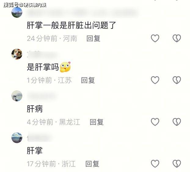 62岁歌手千百惠去世，生前疑呈“肝掌”，业内曝其几月前摔了一跤