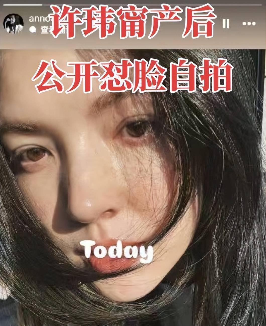 许玮甯产后21天复工！41岁状态惊艳，被网友狂赞是“骨相美人”