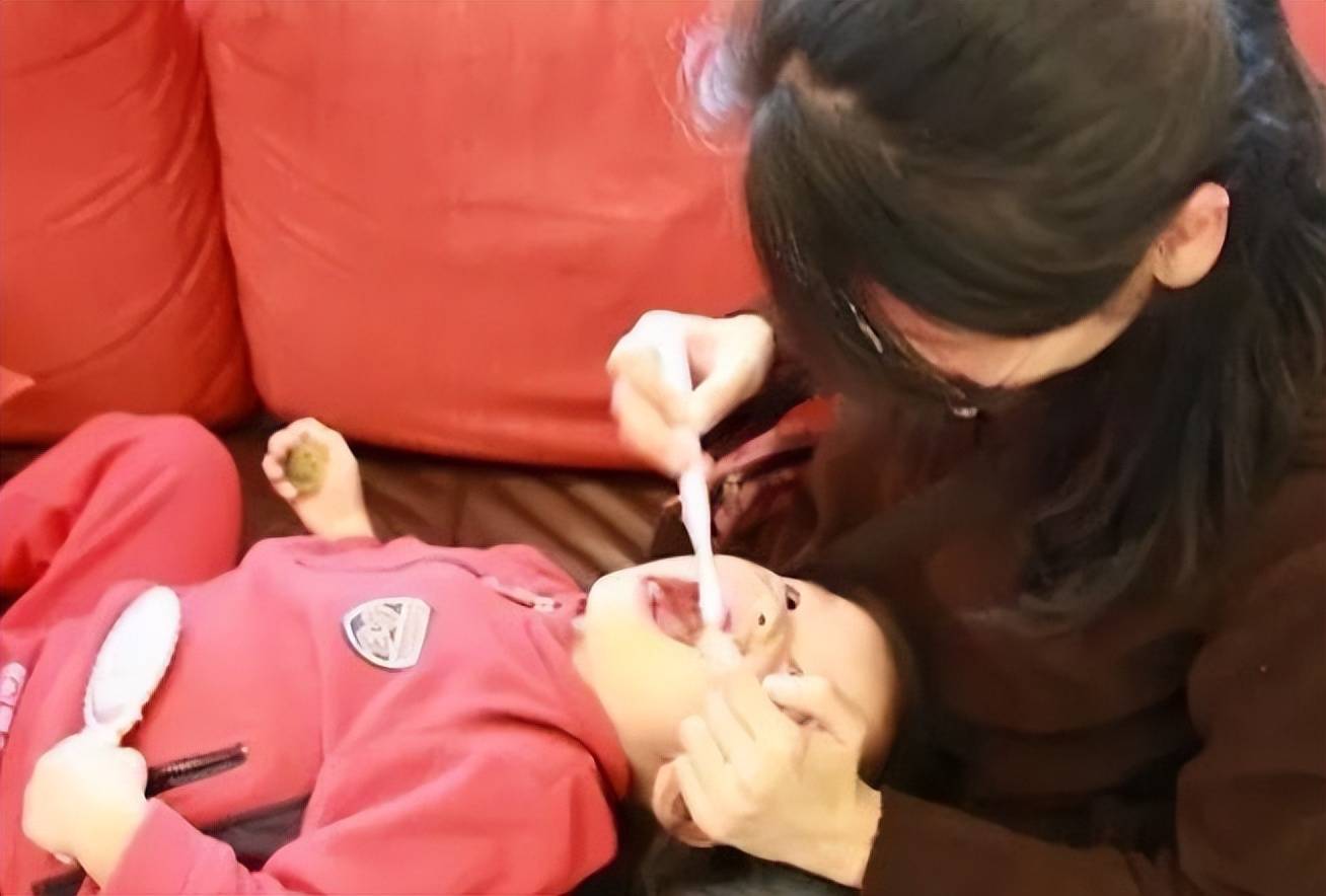 乳牙坏了不用管,换恒牙就没事了?牙科专家给出权威解释