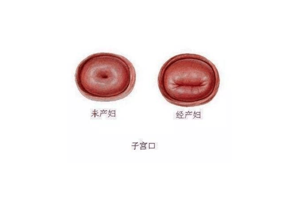 有经验的人,能够一眼看得出来女人有没有生过孩子