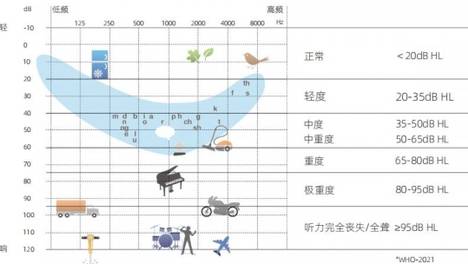 助听器哪个牌子好？国产与进口品牌全方位对比，从做工降噪到售后逐一拆解