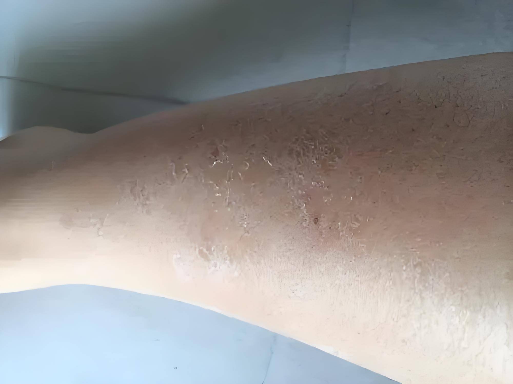 宿迁哪家医院能看皮肤癣？宿迁皮肤病医院：专注解决皮肤癣问题（市哪家医院能看泌尿内科）宿迁皮肤病专科医院哪个好一点，