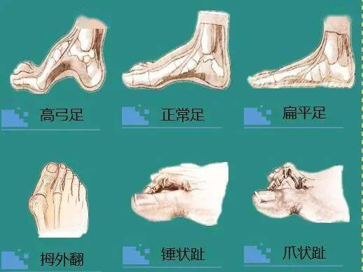 🌸潇湘晨报【澳门特一肖一码免费提】|健康警钟，警惕低血糖昏迷！