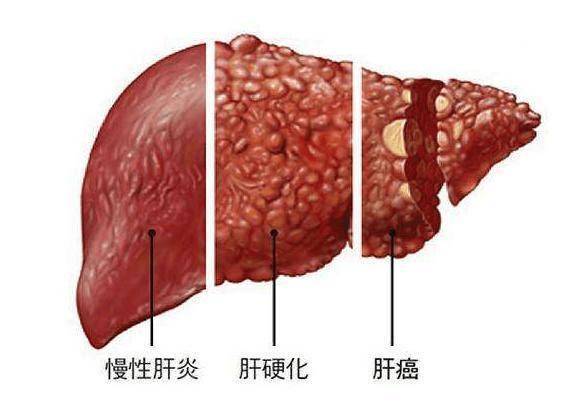 🌸中国水运网 【2024年澳门天天彩免费资料】|AOC 慧学本10W1D惊艳亮相首届健康显示大会 带来高效护眼新方案  第2张