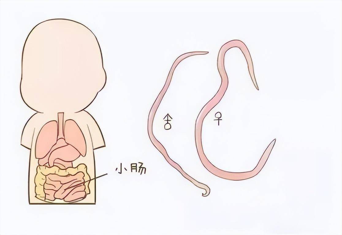 几十年前，人人肚子里几乎都有蛔虫，为什么现在很少见到了？