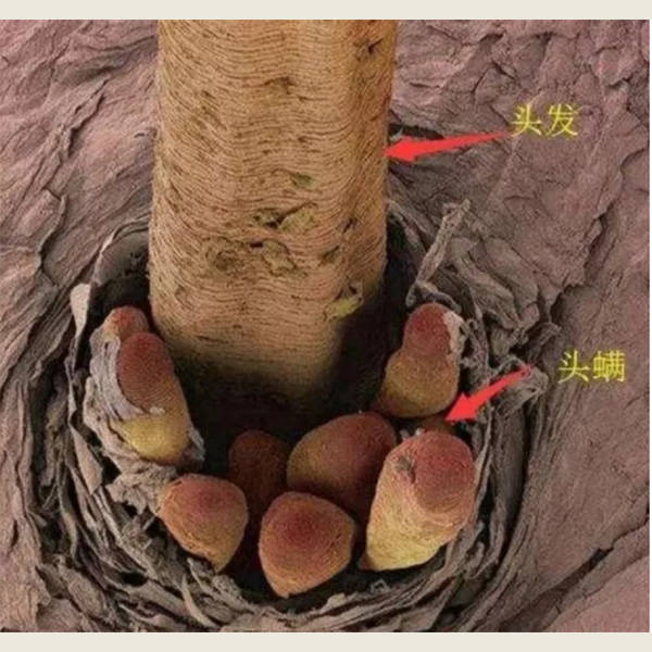 毛囊炎适合用什么洗发水？发根洗发水推荐