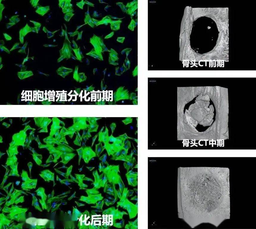 《哪吒》重塑肉身被科学家实现了？用莲藕“重塑骨骼”，8周内实现超95%骨愈合率