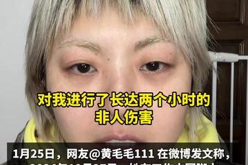 张大大被指殴打辱骂他人 无忧传媒回应称暂停与其一切业务