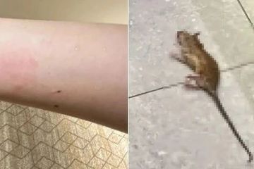 女子称入住全季酒店半夜被老鼠咬醒 工作人员表