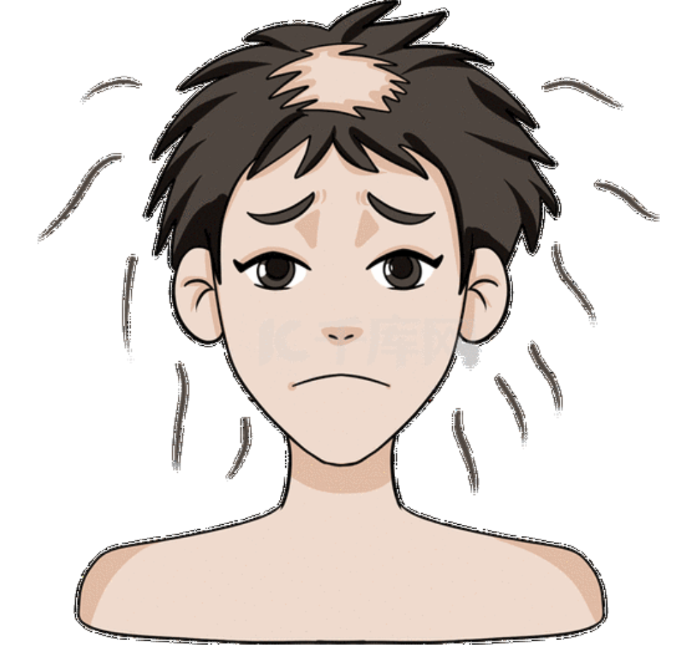 最需要生发的4类人群!快来看看你是不是其中一个_头发_植发_进行