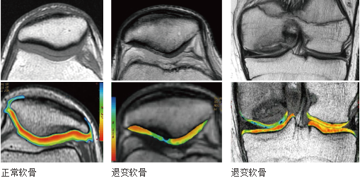 兩江新區中醫院又添院之重器!_成像_檢查_腫瘤