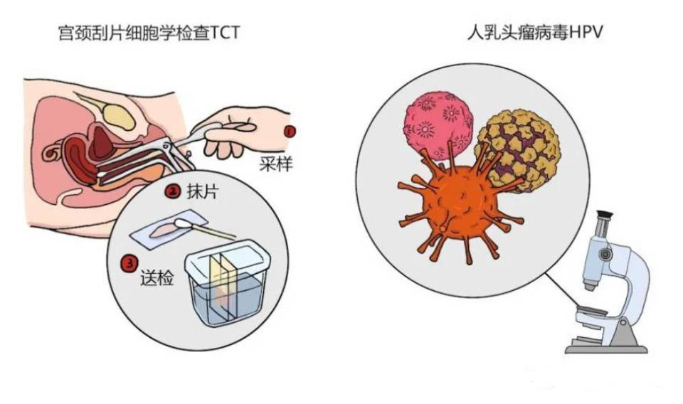 酸酐化牛β-乳球蛋白來預防hpv_傳播_病毒_問題