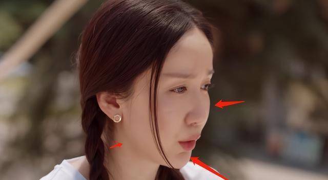 我们这十年:忍了娄艺潇的"肿肿脸",实在忍不了张慧雯的斗鸡眼_角色