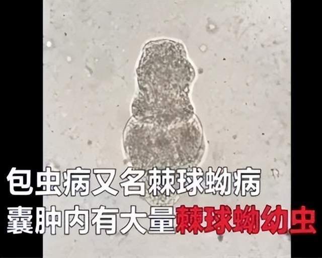 小孩总喊肚子疼是不是肚子里有蛔虫？