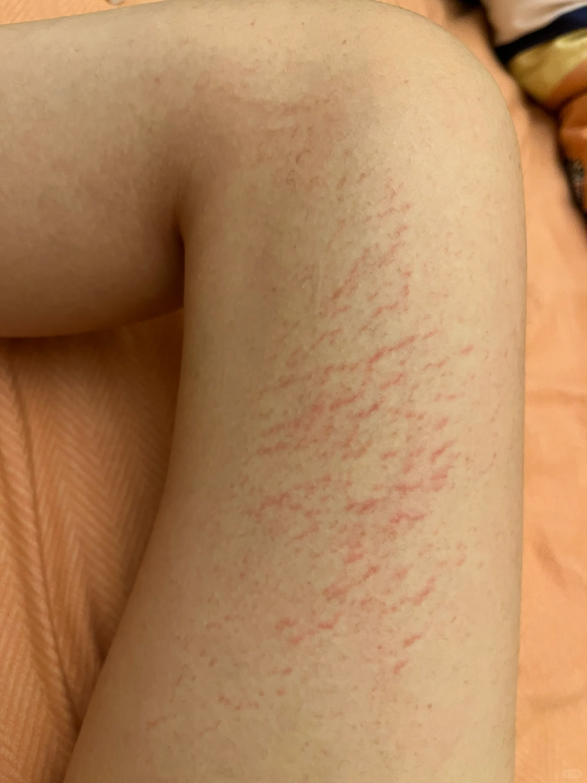 因为_东西_皮肤