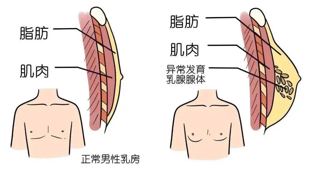 男人乳头正常图片