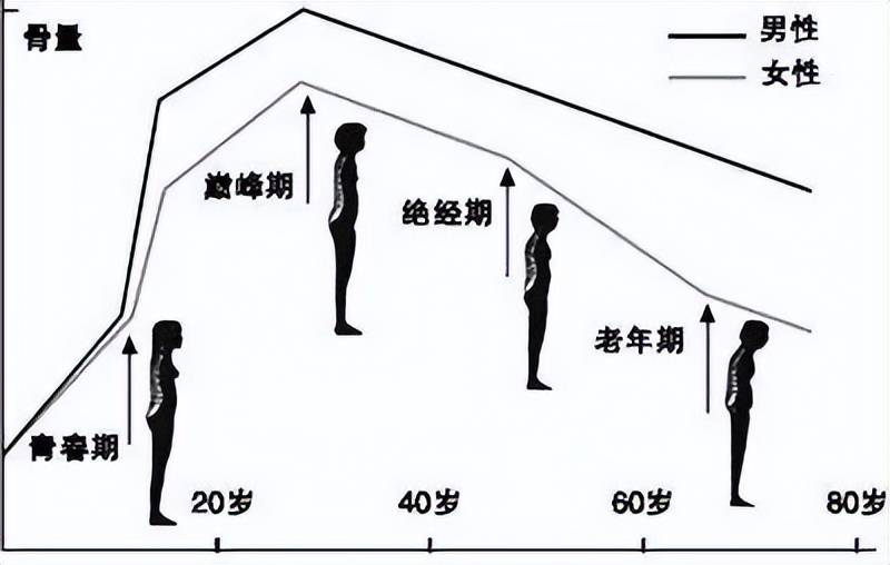 每2位老年女性就有1个骨质疏松 关注4个阶段