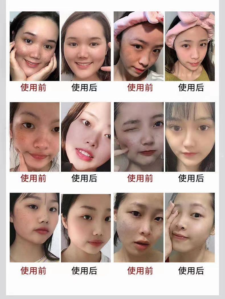 淡斑效果好的护肤品,下面分享给你们哦!_祛斑_肌肤_套装