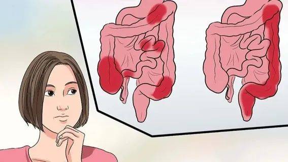 排便时出现这三种异常需警惕肠癌!_时间_肠道_粪便