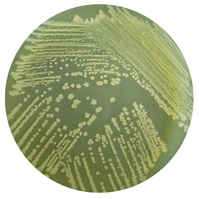 常見微生物培養基介紹_瓊脂_細菌_進行