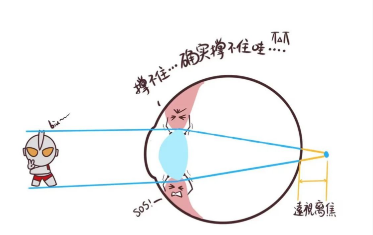 臻祥寿三果眼益:视功能和近视的相关性