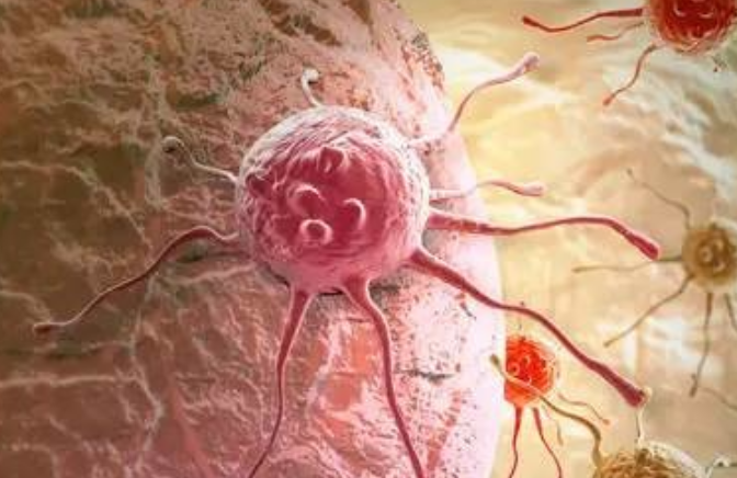 宫颈癌排出分泌物图片图片