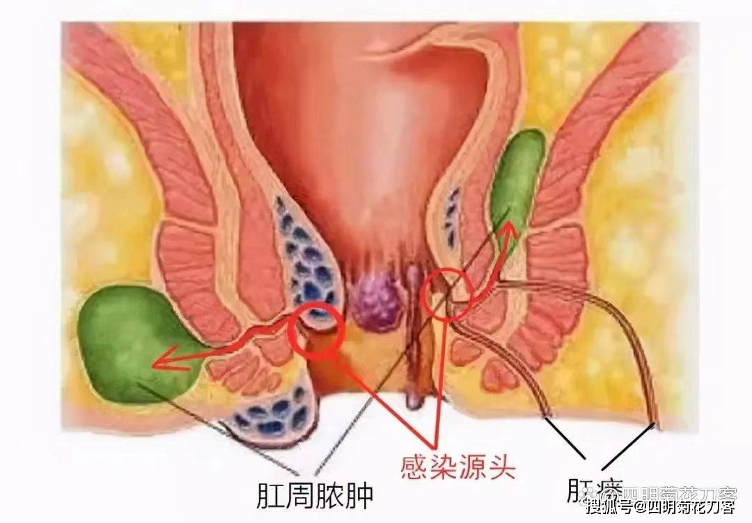 肛门位置图片