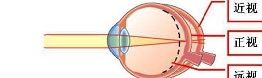 預防孩子視力問題從娃娃抓起,已迫在眉睫_屈光_眼球