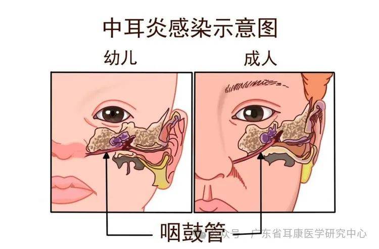 游泳后耳朵不适怎么办?