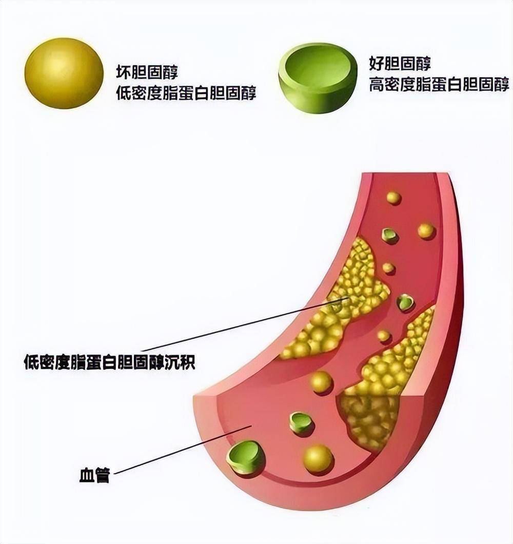 收好"胆固醇含量一览表",最好做到不给血管添堵,可分享 收藏