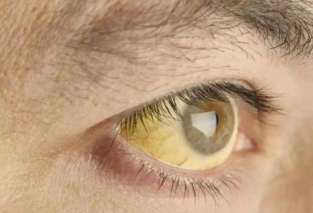 医生建议:想养护肝脏,忌3物,吃2果_肝功能_食品_代谢