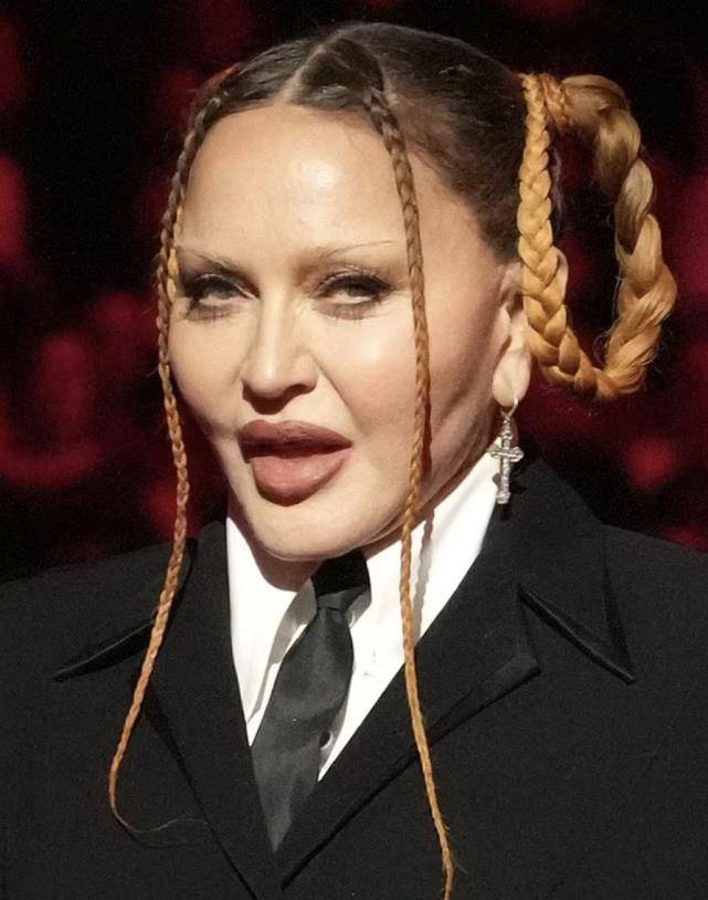 64岁麦当娜亮相格莱美,整容痕迹过重,面目全非:这胖姑娘是谁