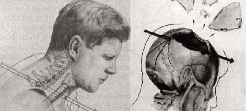 为何"肯尼迪遇刺"成为悬案,那颗子弹又被称为"魔术子弹"_奥斯_瓦德