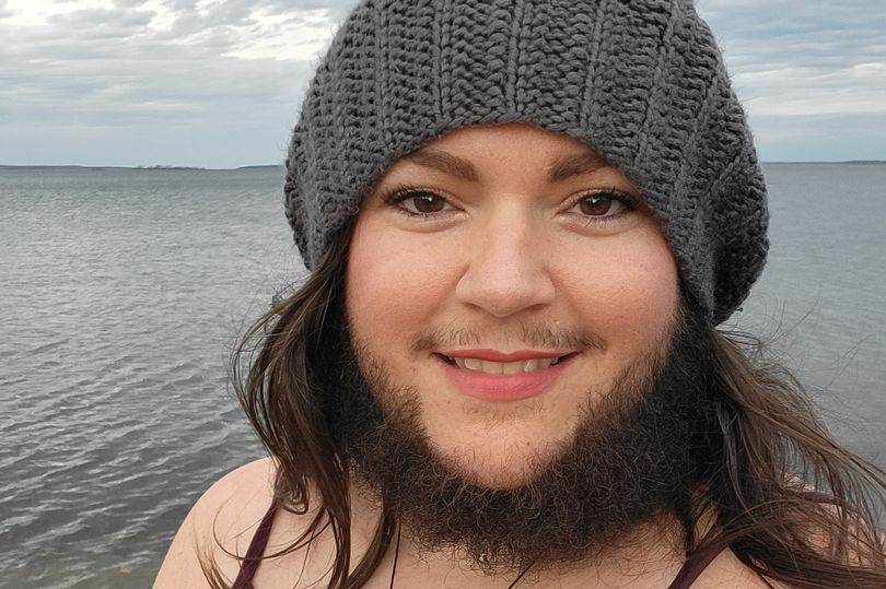 原创加拿大女子爱自己的胡子曾经有人对她大喊大叫如今获得更多支持