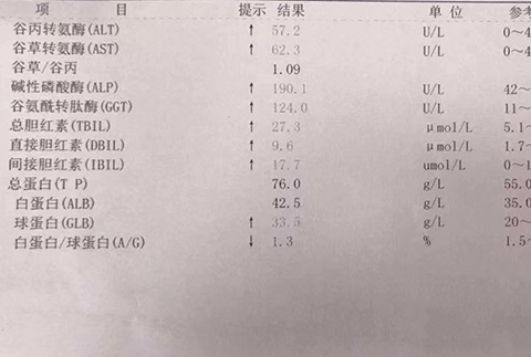 肝功能检查需要多少钱图片