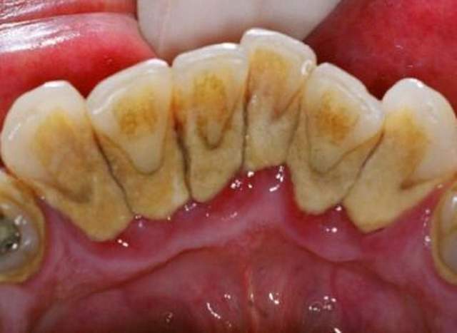 入嘴很是顺滑,味道也是淡淡的薄荷味,刷的时候有点像嚼绿箭口香糖似得