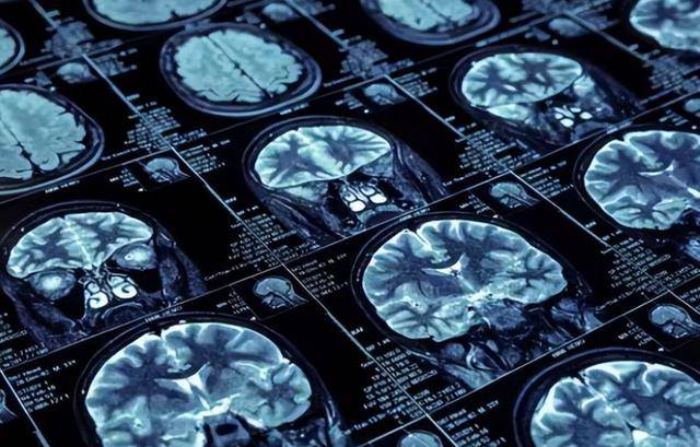 照一次ct,对人体有伤害吗?