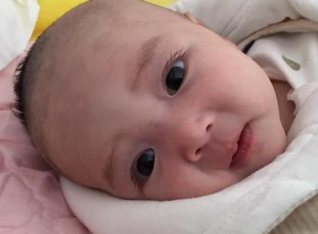 如果新生儿的爸妈又是大眼睛,又是双眼皮,那么孩子小眼变大眼的情况会