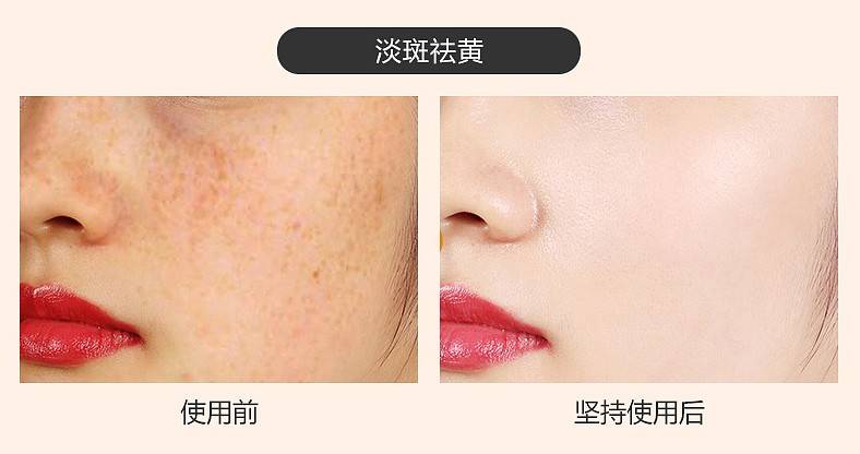 淡斑紧致抗皱的护肤品,这款很爱哦!_肌肤_祛斑_效果