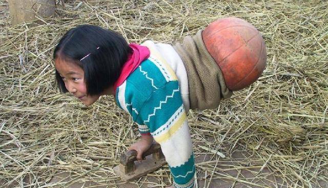 "篮球女孩"钱红艳:因一场车祸失去双腿,却靠半截身躯勇夺冠军_孩子