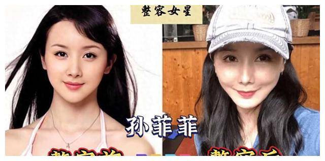 整容毁容!14位女星被毁了颜值,从容颜花美变僵硬无灵._风波_内心_魅力