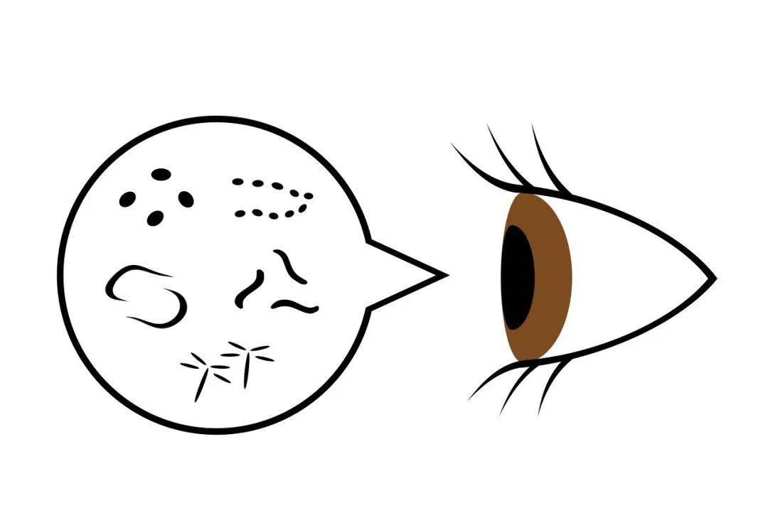 武汉普瑞眼科医院许泽骏院长在线解答_蚊子_玻璃体_视网膜